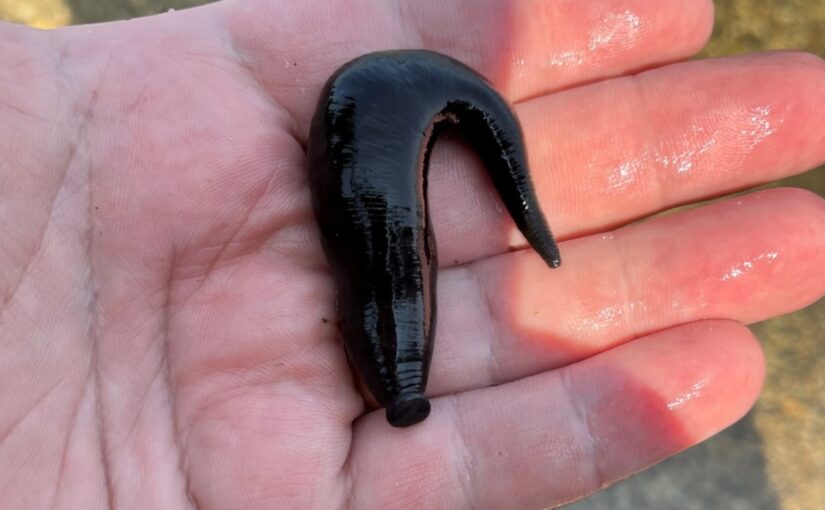 leech on person's hand